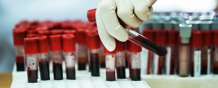 Real Blood Vials Not That Getty Nonsense 1024
