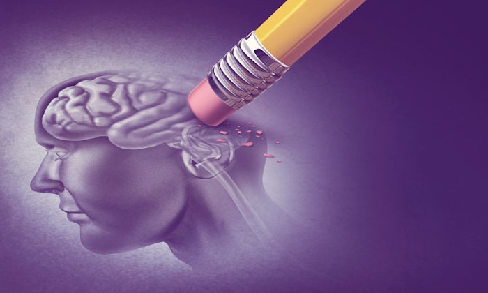 Ai Algorithm Alzheimers