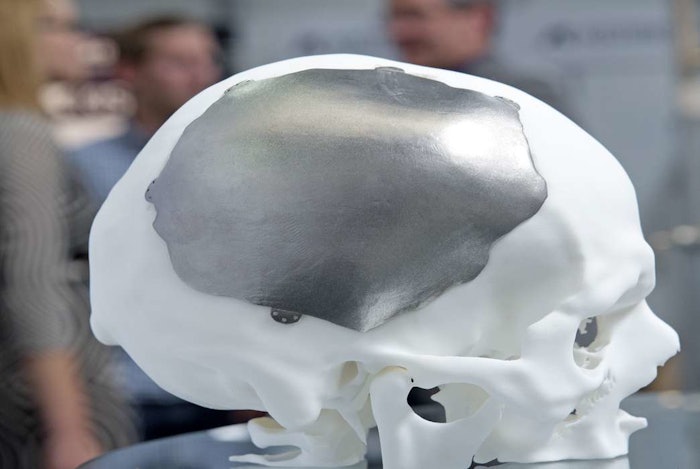 3d Bones2 I Ek Dldi