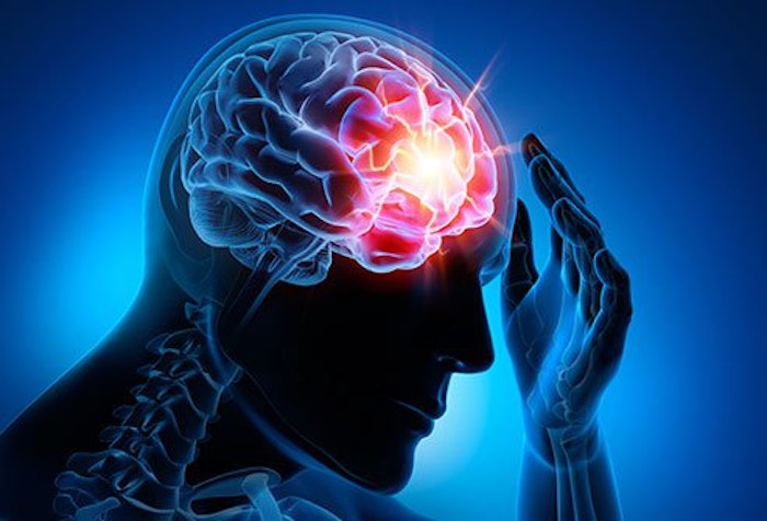 Concussion 2