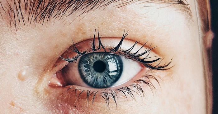 Eye Pexel Dhyamis Kleber