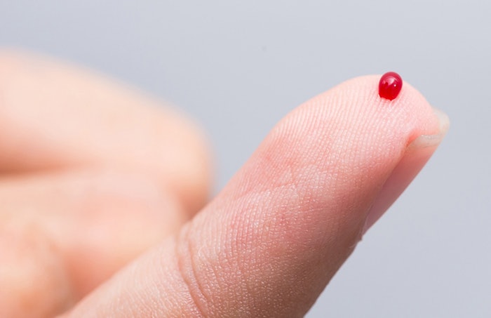 Drop Of Blood On Finger