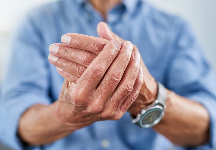 Arthritis Myths 1164168739 770x533 1