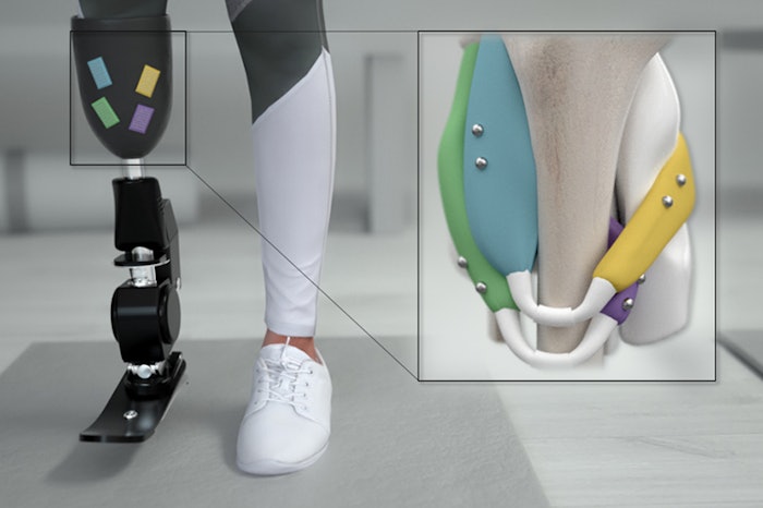 Magnetic Beads For Limbs