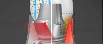 Researchers Developing 1