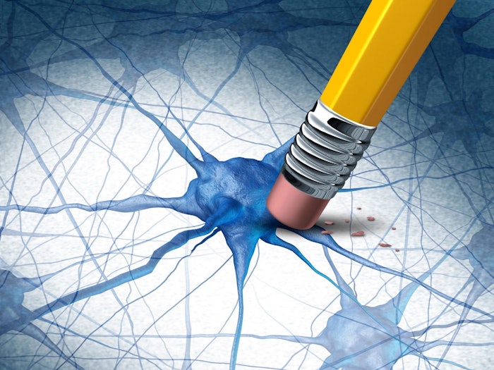 Alzheimers Dementia Brain Disease Concept 1536x1152