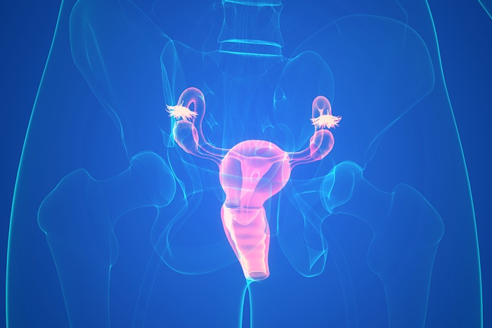 Ovarian Cancer Main