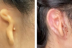 02ear4 Facebook Jumbo