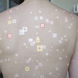 Ai Skin Cancer Detection