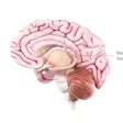 Nia Brain Medical Graphic For Parkinsons Disease 102721 500px 02