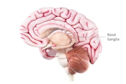 Nia Brain Medical Graphic For Parkinsons Disease 102721 500px 02