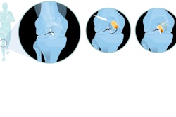 Og Gk961 3d3fdb 700 Px 20220907125706