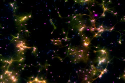 Dishbrain under a microscope