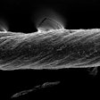 Mit Smart Sutures 01 Press 0