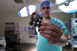 Implanted Ultrasound