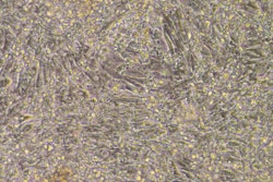 Prof Karl Tryggvason & Dr Lynn Yap