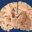 Cns136