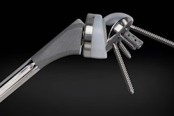 The Equinoxe Shoulder System by Exactech up until August 2021 were packaged in defective bags and may be at risk of oxidation.